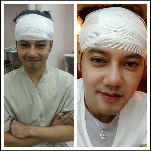 ซูมกันชัด ๆ หน้า ดีเจเจ๊แหม่ม หลังการทำศัลยกรรม