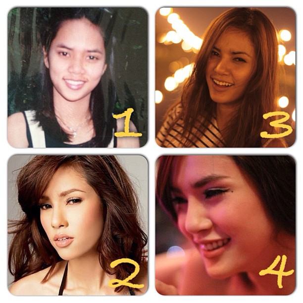 อุ้ม ลักขณา โพสต์แจงศัลยกรรม ยัน ไม่ได้ทำทั้งหน้า