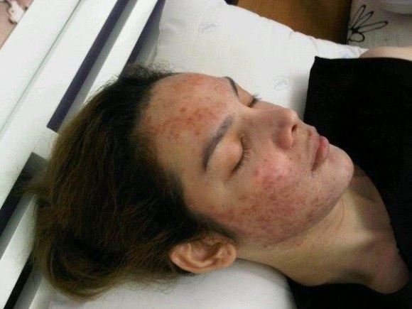 &lrm;แจ๊ส มิสทิฟฟานี่ หน้าพังยับ จนอยากฆ่าตัวตาย