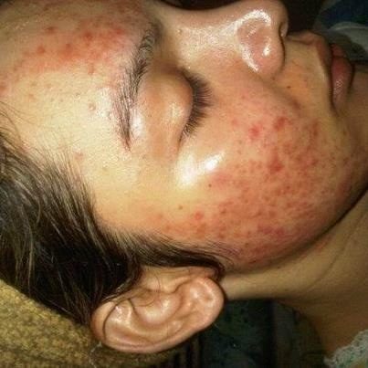 &lrm;แจ๊ส มิสทิฟฟานี่ หน้าพังยับ จนอยากฆ่าตัวตาย