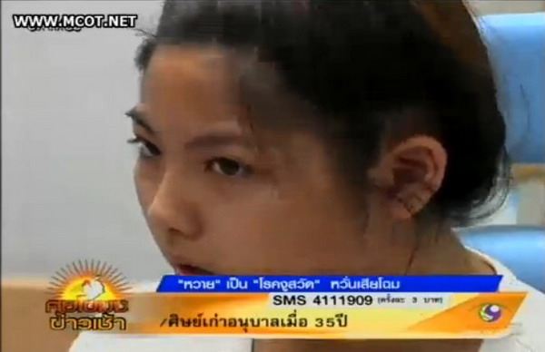 หวิดเสียโฉม'งูสวัด'ขึ้นหน้า'หวาย ปัญริสา'