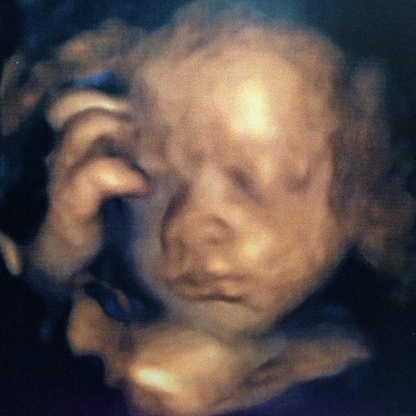 ชมกันชัด ๆ ภาพอัลตราซาวด์ หน้าลูกชาย ป๋อ ณัฐวุฒิ - เอ๋ พรทิพย์