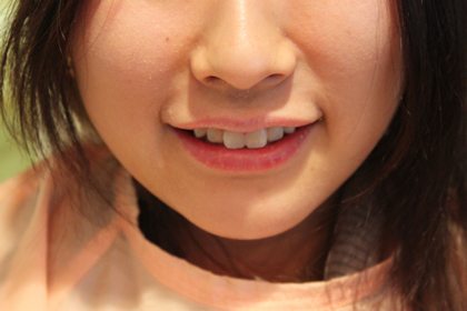 สึเคะ-ยาเอบะ เทรนด์ต่อฟันเขี้ยวที่มาแรงสุด ๆ ในญี่ปุ่น