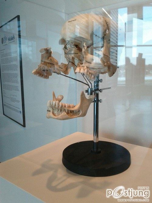 มองให้อาร์ท 61