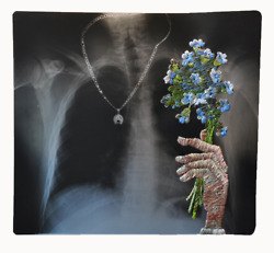 มองให้อาร์ท 62