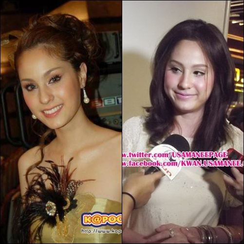 คุณคิดว่าตอนนี้ 'ขวัญ อุษามณี' หน้าบวมขึ้นกว่าแต่ก่อนรึป่าว ?