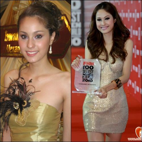 คุณคิดว่าตอนนี้ 'ขวัญ อุษามณี' หน้าบวมขึ้นกว่าแต่ก่อนรึป่าว ?