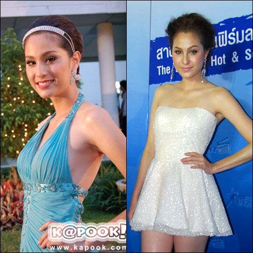 คุณคิดว่าตอนนี้ 'ขวัญ อุษามณี' หน้าบวมขึ้นกว่าแต่ก่อนรึป่าว ?