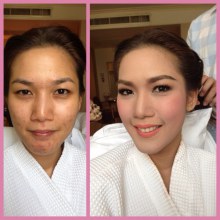 #before #and #after เพราะจะได้เห็นรอยสิวและโครงหน้าชัดๆค่ะ  #no-app #noretouch