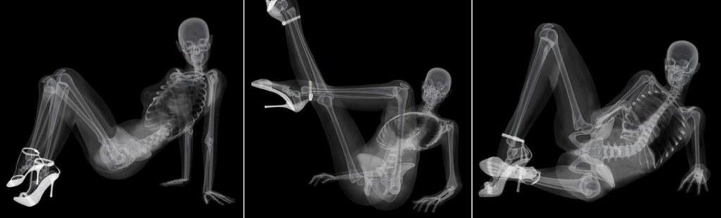 ศิลปะ ภาพเอ็กซเรย์ (x-rays)