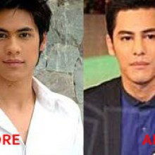 จมูกใหม่? เมาส์ ซี ศิวัตน์ ศัลกรรมจมูก หน้าดูคมขึ้น !!!