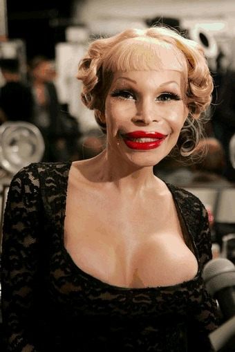 อันดับที่ 9 Amanda Lepore   ดารานางแบบสาวประเภทสอง ชาวอเมริกัน