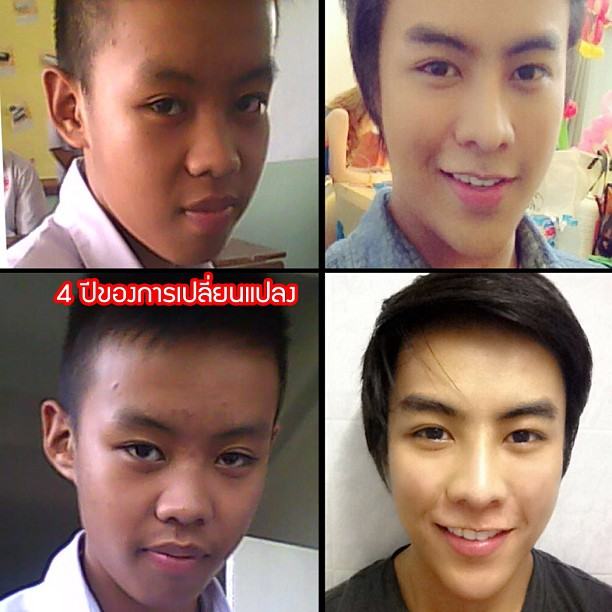 รักษ์ ศัลยกรรม