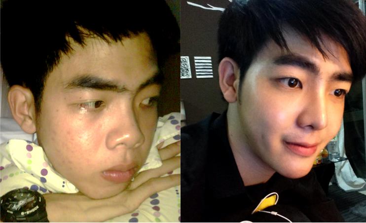 สวยหล่อไม่ต้องรอชาติหน้า