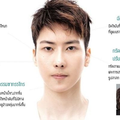 LET ME IN : โรงพยาบาลไอดี คุณหมอปาร์ค~amazing makeover!