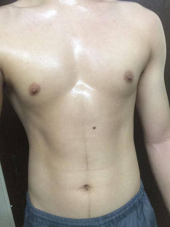 male body 106