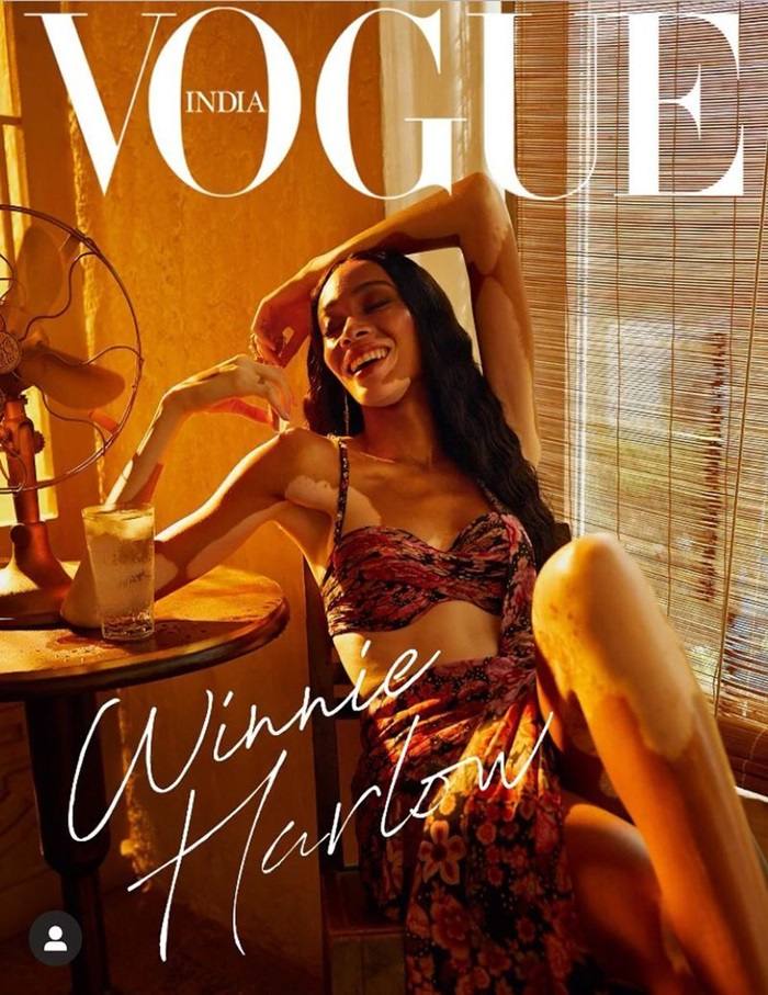 Winnie Harlow @ Vogue India March 2020