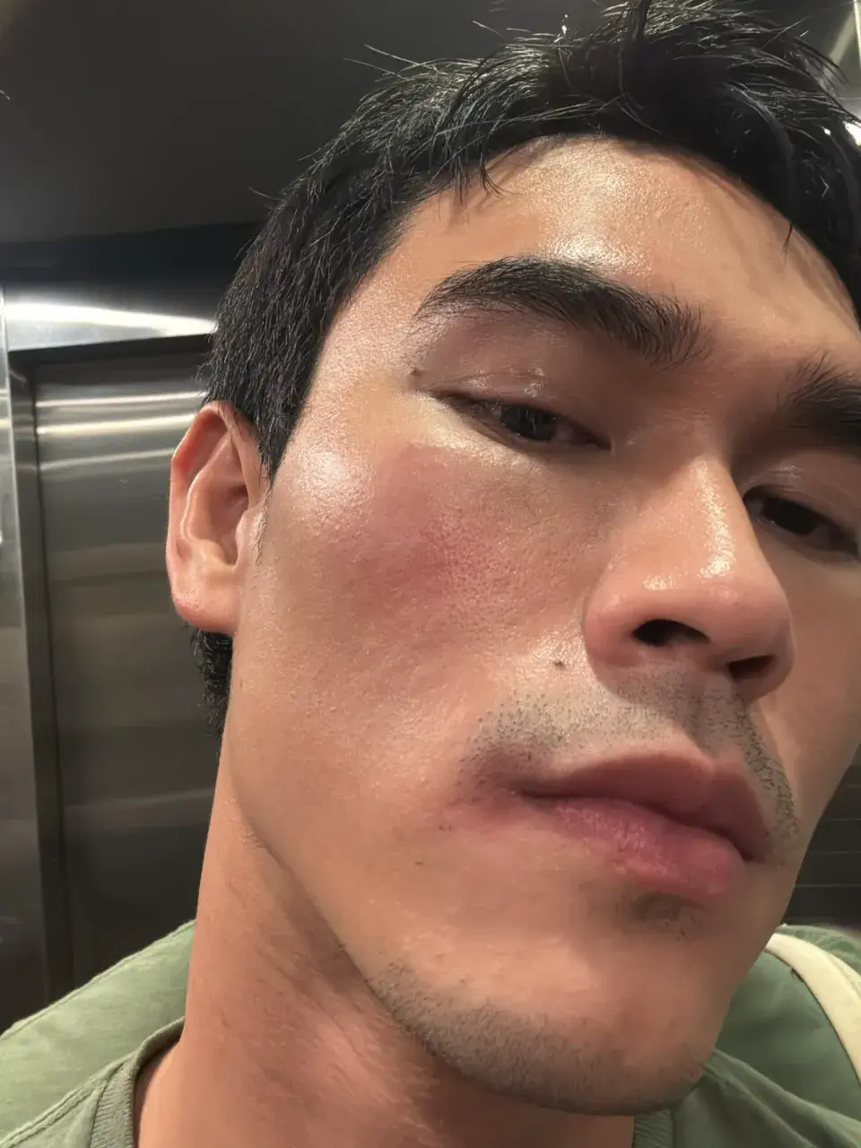 แก้เครียดกับสถานการณ์บ้านเมืองมาดูผู้