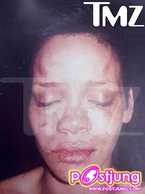 โดนซ้อมแล้ว