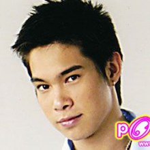 พีท เดอะสตาร์ รูป ก่อน-หลัง ศัลยกรรม