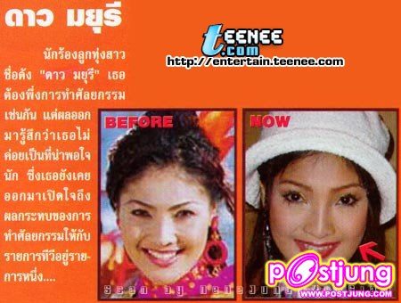 ดารากับ การทำศัลยกรรม