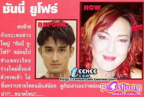 ดารากับ การทำศัลยกรรม