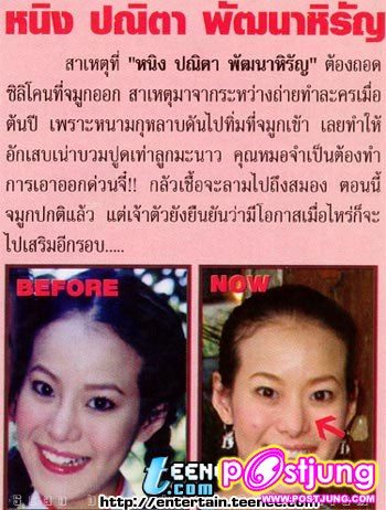 ดารากับ การทำศัลยกรรม