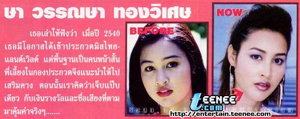 ดารากับ การทำศัลยกรรม