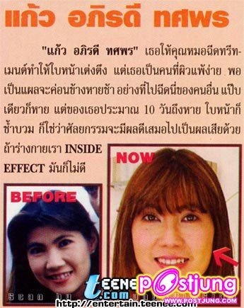 ดารากับ การทำศัลยกรรม