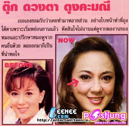 ดารากับ การทำศัลยกรรม