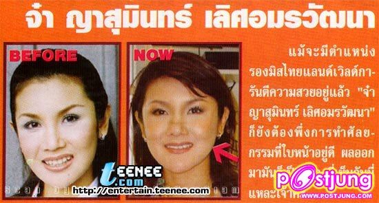 ดารากับ การทำศัลยกรรม