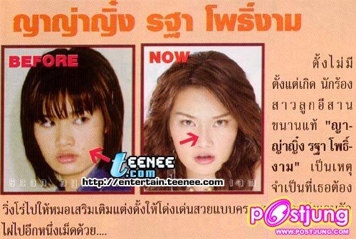 ดารากับ การทำศัลยกรรม