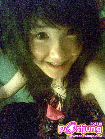 อันนี้เพิ่งดัดฟัน