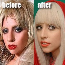 Hollywood Plastic Surgery