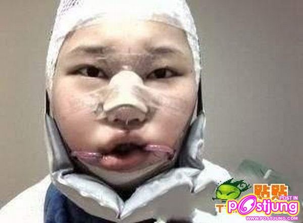 เย้ยยยย