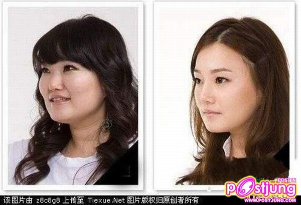 กลายเป็นคนใหม่เรย