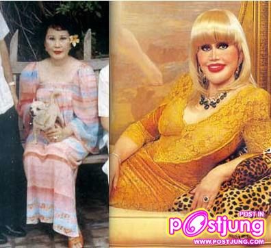 ก่อนและหลังการทำศัลยกรรม