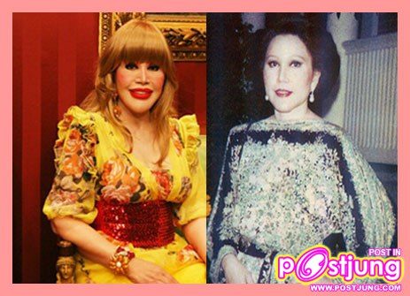 ก่อนและหลังการทำศัลยกรรม