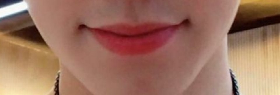 ริมฝีปากนี้คือของใคร?