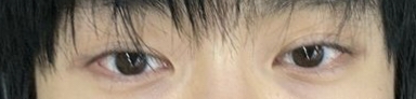 Whose eyes are this?