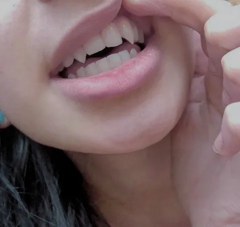 Canine teeth