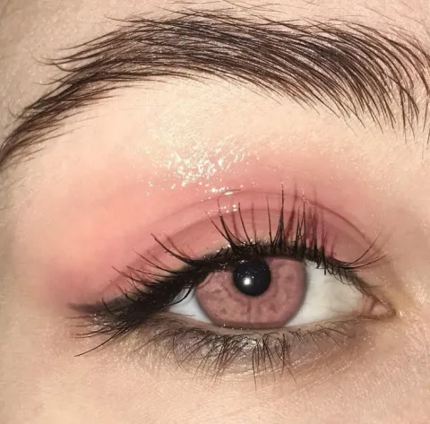 Pink eyes