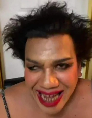 ทั้งเหยิน ทั้งห่าง ทั้งดำ หินปูนเต็ม ไม่มีชิ้นดี