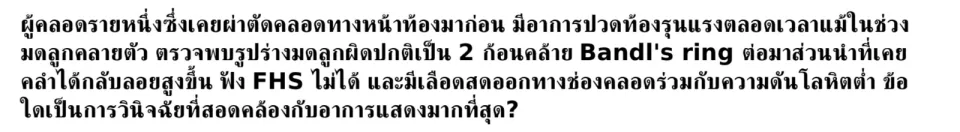 ข้อใดถูกต้อง