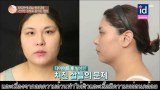 LET ME IN SEASON5 : แปลงโฉมสาวอ้สนเปลี่ยนเป็นดาราเกาหลี