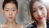 ศัลยกรรมเปลี่ยนตัวเอง...สาวเกาหลีแบบหนูยังยอมสยบหมอไทย!!! (รูปเยอะนะ)