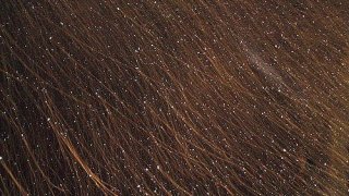 รังแคคืออะไร