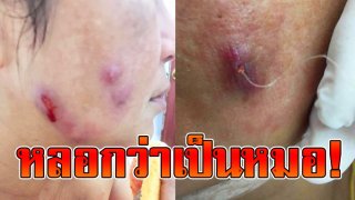 สวยสยอง! หมอปลอมเปิดคลีนิคฉีดโบท็อกซ์ ร้อยไหม ทำหน้าพัง!