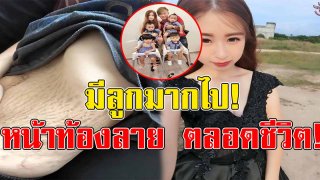 คุณแม่วัย 23 โพสต์ภาพเผยหน้าท้องลายเกินเยียวยา บอกเป็นความผิดเธอเอง เพราะมีลูกมากไป!