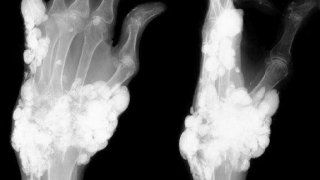 ภาพน่าขนลุกของร่างกายมนุษย์ ที่หลายคนอาจไม่เคยเห็นมาก่อน (แม้จะสยอง แต่สาระล้วนๆ) ตอนที่ 1